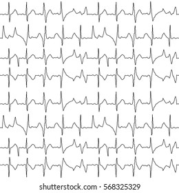 Seamless Pattern Of The Ekg Cardiograms Chart.