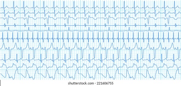 Seamless pattern of the ekg cardiograms set