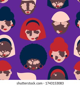seamless pattern with people of different nationalities suffering from vitiligo disease. Modern design for clothes, packaging, paper, cover, fabric