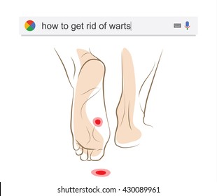 Searching the web for information about getting rid of warts vector illustration