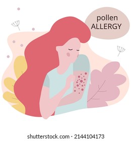 Seasonal Allergy. Woman With Red Skin Rash. Woman Scratching Skin On Her Hand