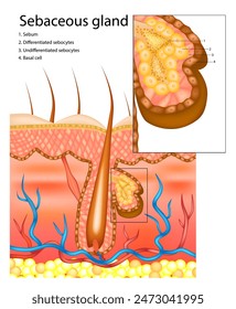 Glándula sebácea o glándula oleosa. Corte transversal de todas las capas de la piel. Un folículo piloso con estructuras asociadas. Diferenciación de la glándula sebácea