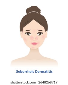 Dermatite seborreica em mulher face ilustração vetorial. Sebderm, inflamado, manchas vermelhas com escamas brancas ou amarelas na face, lados do nariz, sobrancelhas, orelhas, pálpebras. Cuidados com a pele e conceito de beleza.