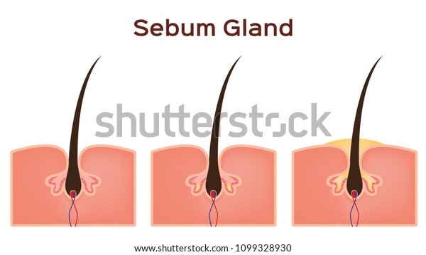 sebum oil gland in human\
skin vector