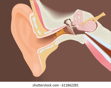 Section of the ear with the earwax - colorful diagram