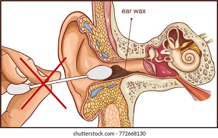 Image result for earwax stock images