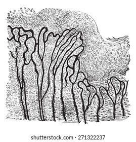 Section through the border of a healing wound, vintage engraved illustration. 