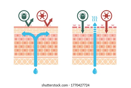 Sectional view of atopic dermatitis and normal skin / Comparative vector illustration (no text)