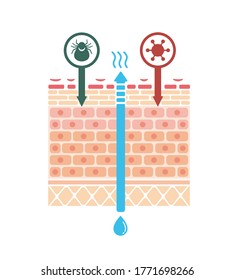 Vista seccional de dermatitis atópica / ilustración vectorial (sin texto)