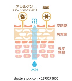 Sectional view of the skin. wounded skin illustration (Japanese) . Translation: epidermis,dermis,allergen,virus,bacteria,sebum.