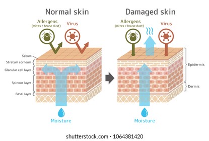 1,519 Skin barrier Images, Stock Photos & Vectors | Shutterstock