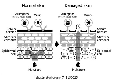 Sectional view of the skin.Comparison illustration of protection effect between healthy skin and wounded skin. With text. 
