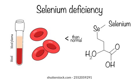 Deficiencia de selenio. Un análisis de sangre de selenio, que reveló una deficiencia de este microelemento. Ilustración vectorial sencilla para diferentes usos.