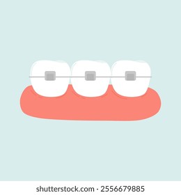 Self Ligating Orthodontic Braces Illustration