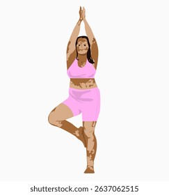 Self-acceptance woman with vitiligo relaxing in yoga. Body positive, brunette girl with skin depigmentation or pigmentation. Flat vector cartoon illustration isolated on white background.