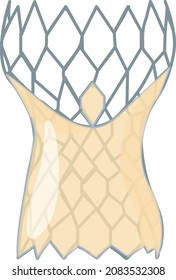 Self-expanding TAVR valve prosthesis illustration