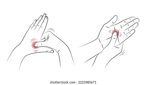 Self-massage of palms of hands, close-up. Human presses special points on palm to relieve headaches and other pains. Health and wellness acupressure manipulations. Alternative medicine, reflexology