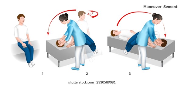 Semont maneuver is a methodological guide for students with the help of a doctor step by step instructions. Treatment of benign positional paroxysmal vertigo. Vector.