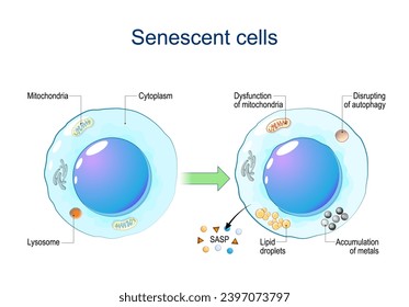 Senescent cells. Cellular senescence from Dysfunction of mitochondria, accumulation of metals, Disrupting of autophagy, Lipid droplets to release of Senescence-associated secretory phenotype SASP