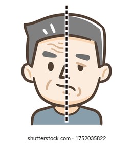 Senior Citizen Of Facial Nerve Palsy