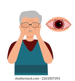 Hombre mayor con dolor ocular en diseño plano sobre fondo blanco. Ilustración vectorial de concepto ocular irritada.