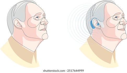 Hombre mayor con audífono y oye bien. Concepto de tratamiento de otorrinolaringología. Dibujo de una línea de dispositivo de atención médica, tecnología de medicina. Ilustración vectorial.