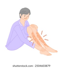 Senior woman with dry, rough and itchy skin on her feet