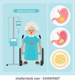 Senior Woman Patient With Gastric Cancer In Cartoon Style.