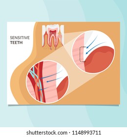 Sensitive teeth infographic