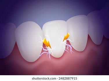 Sensitive teeth sharp pain like an electric shock or lightning strike. Tooth sensitivity treatment symptom concept. Realistic vector illustration.