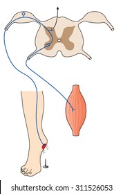 Sensory nerve message from pain stimulus crossing spinal cord to motor neuron to effect the pain reflex