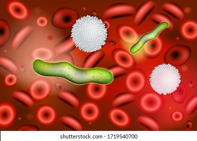 
Sepsis (Blood Infection). Etiologic Agents of Bacterial Sepsis. Sepsis is an inflammatory immune response triggered by an infection.