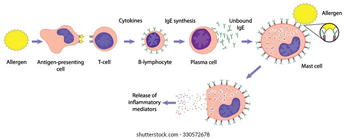 Sequence of events caused by an allergen resulting in the release of histamine and other inflammatory mediators.