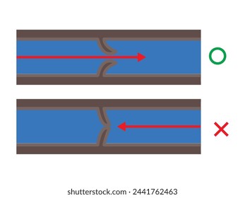 A series of one-way valves which are called venous valves, conduct the blood toward the heart and prevent its backflow. Inadequacy in the venous valves results in leaking back of blood toward the legs
