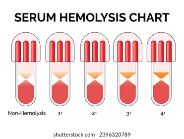 Serum Hämolysis Diagramm Science Design Vektorgrafik