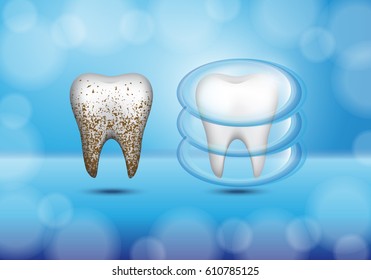 Set of 3d realistic dirty and clean tooth on blue backdrop,clearing tooth process.Oral care concept,teeth restoration.For mobile user interface,stomatology poster,placard and flyer