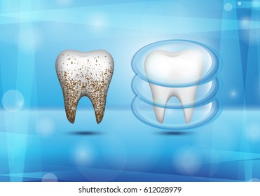 Set of 3d realistic dirty and clean tooth on blue backdrop,clearing tooth process.Oral care concept,teeth restoration.For mobile user interface,stomatology poster,placard and flyer