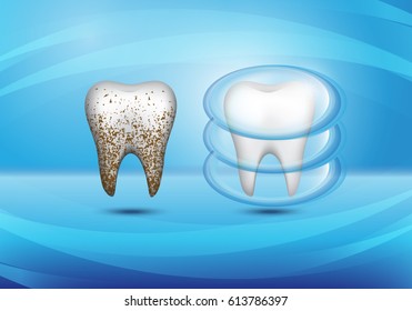 Set of 3d realistic dirty and clean tooth on blue backdrop,clearing tooth process.Oral care concept,teeth restoration.For mobile user interface,stomatology poster,placard and flyer