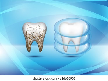 Set of 3d realistic dirty and clean tooth on blue background,clearing tooth process.Oral care concept,teeth restoration.For mobile user interface,stomatology poster,placard and flyer