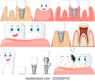Conjunto de todos los tipos de dientes en la ilustración de fondo blanco