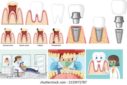 Set of all types of teeth on white background illustration