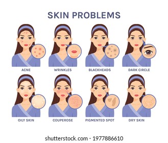 Set of Beautiful cartoon Woman and Skin Problems.Portrait of a Girl and close-up of facial Diseases: Acne, Blackheads, Wrinkles, Dark circles, Oily skin, Couperose, Pigmented spota, Dry. Vector.