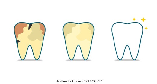 Se coloca antes después de diferentes manchas de caries dentales de dientes al personaje de dibujos animados dentales de dientes limpios y brillantes blancos sobre el diseño de vectores planos de fondo blanco.