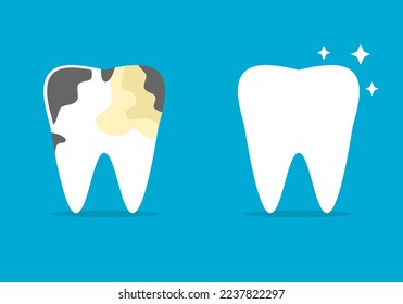 Set before after different tooth decay stains to white shiny clean tooth dental cartoon character on blue background icon flat vector design.