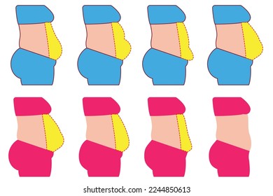 The set of bellies in obesity. Belly fat, weight loss, before and after. Highlighted problem area