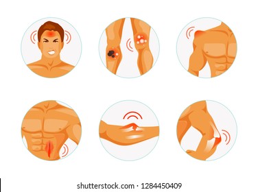 Set body parts with various types of injuries. Concussion, burn, bruise, injury, fracture and dislocation. Vector illustration