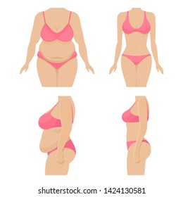 Set body of a woman before and after losing weight. Fat and thin female body. Belly and breasts of a girl after losing weight. Vector illustration isolated on white, flat.