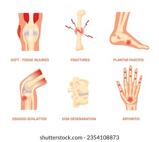 Enfermedades óseas, lesiones de tejidos blandos, fractura, fasciitis plástica, osgood-schlatter, disco degenerativo, artritis