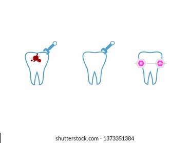 
Set of cartoon illustrating dental procedures, hygiene and health.Braces, tooth extraction, decay,Linear tooth filling icon from Dentist outline collection. 