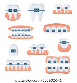 Set of cartoon style vector ceramic braces isolated on white background. Straight teeth, beautiful smile. Orthodontic treatment, dentistry services, teeth correction.